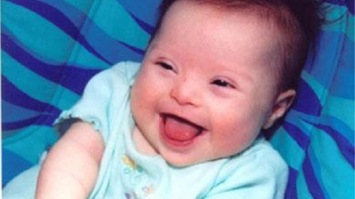 Downsyndromebaby29